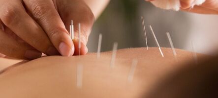 Základy akupunktury - metodou TČM